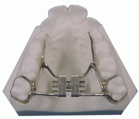 palatal-expander