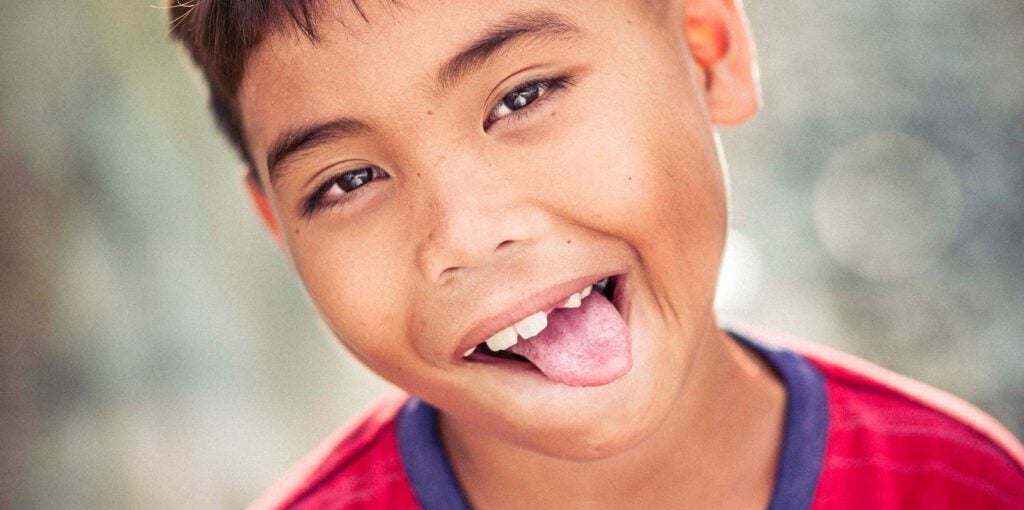 Lingual Frenectomy tongue tie Loveland