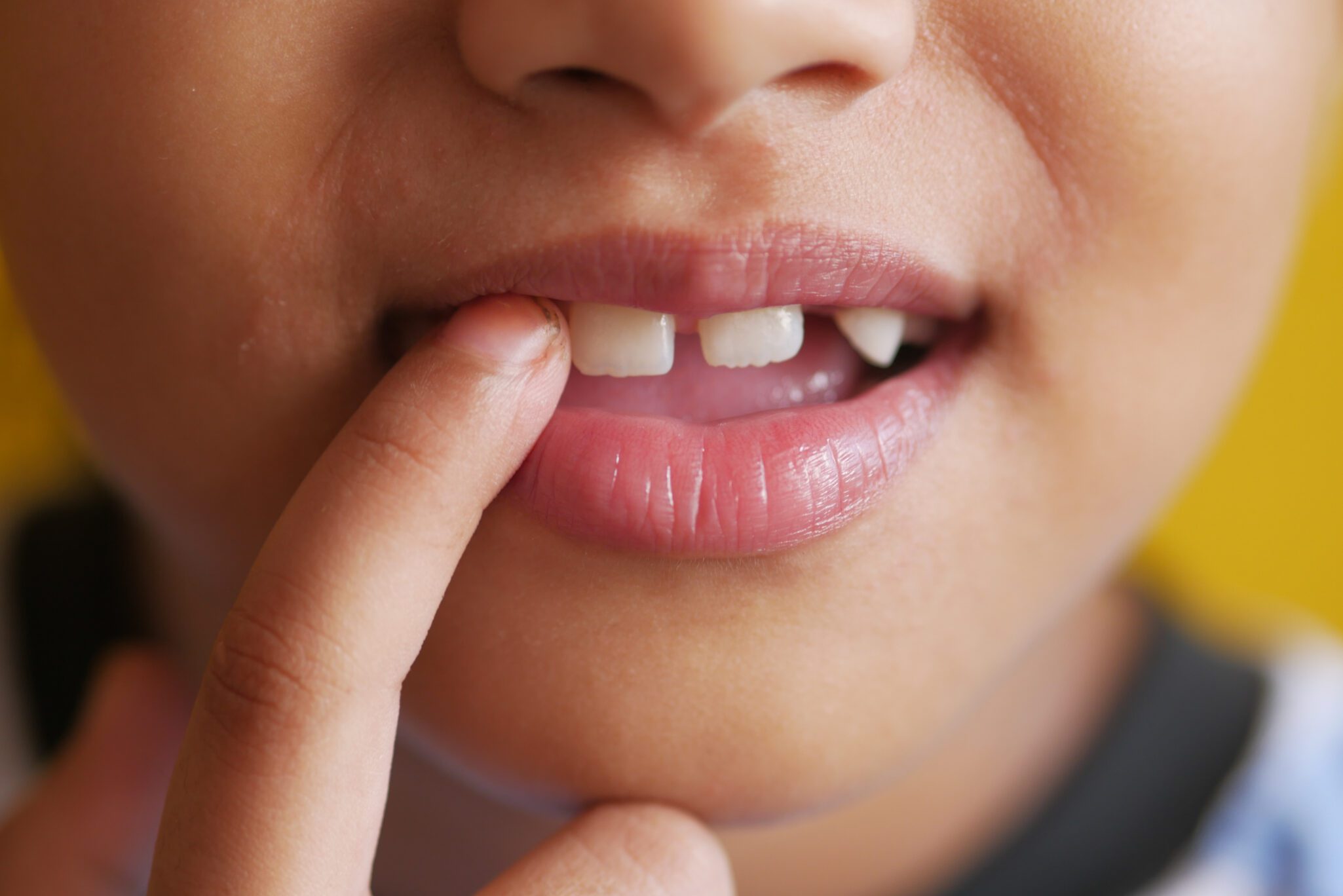 Loveland pediatric dentist
