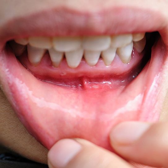 - The ToothZone Network- Dentists in Fort Collins and Loveland